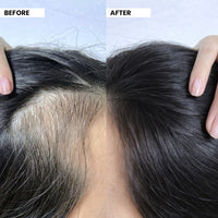 FreshLuxe Onion & Rosemary Growth Boost Shampoo for Men & Women 200 ml