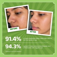 Ghar Soaps Master Serum | For skin brightening | With Green Tomato, LHA, PHA & BHA | For combination & Acne-prone skin 30ml - 5