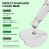 Ghar Soaps Salicylic Acid Serum 2X + Eraser 2X Formula | Acne & Pimple Eliminator | Deep Pore Cleanser & Oil