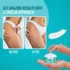 Gynocup Stretch Marks Removal Cream for Pregnancy 50 gm