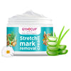 Gynocup Stretch Marks Removal Cream for Pregnancy 50 gm