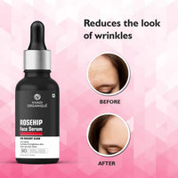 Khadi Organique Rosehip Face Serum For Radiant Glow 30 ml