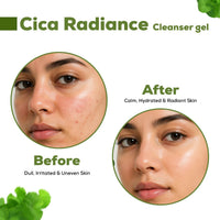 OLAMOR Cica Radiance Cleanser Gel - 120gm