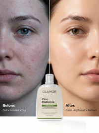 OLAMOR Cica Radiance Cleanser Gel - 120gm