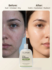 OLAMOR Cica Radiance Cleanser Gel - 120gm