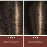 Olamor Eliminar Anti-Dandruff Shampoo for Dry Hair 300ml