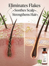 Olamor Eliminar Anti-Dandruff Shampoo for Dry Hair 300ml