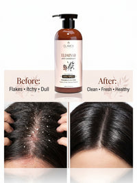 Olamor Eliminar Anti-Dandruff Shampoo for Dry Hair 300ml