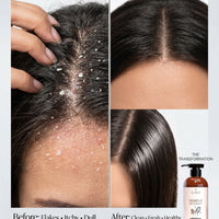 Olamor Eliminar Anti-Dandruff Shampoo for Dry Hair 300ml