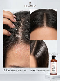 Olamor Eliminar Anti-Dandruff Shampoo for Dry Hair 300ml