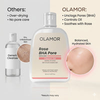 OLAMOR Rose BHA Pore Cleanser Gel - 120gm