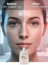 OLAMOR Rose BHA Pore Cleanser Gel - 120gm