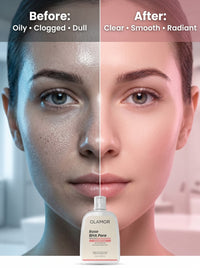OLAMOR Rose BHA Pore Cleanser Gel - 120gm