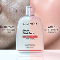 OLAMOR Rose BHA Pore Cleanser Gel - 120gm