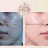 OLAMOR Rose BHA Pore Cleanser Gel - 120gm