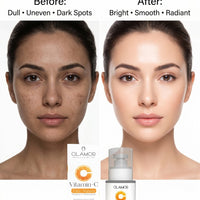 OLAMOR Vitamin C Face Serum - Improves Skin Whitening Tone - 30ml