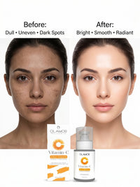 OLAMOR Vitamin C Face Serum - Improves Skin Whitening Tone - 30ml