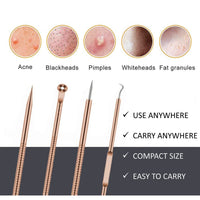 Majestique Blackhead Removal Kit 4 Pieces