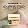 Realmyth Stretchlite cream 50 gm