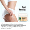 Realmyth Stretchlite cream 50 gm