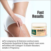 Realmyth Stretchlite cream 50 gm
