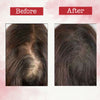 Sotrue Derma Roller