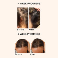 Skog Super Hair Repair 30 ml