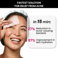 ThriveCo Goodbye Acne Serum 30 ml