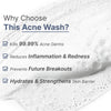 WildOak 2.5% Benzoyl Peroxide Acne Body Wash | 300ml