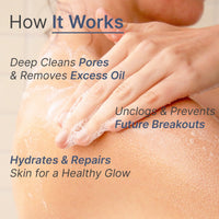 WildOak 2.5% Benzoyl Peroxide Acne Body Wash | 300ml