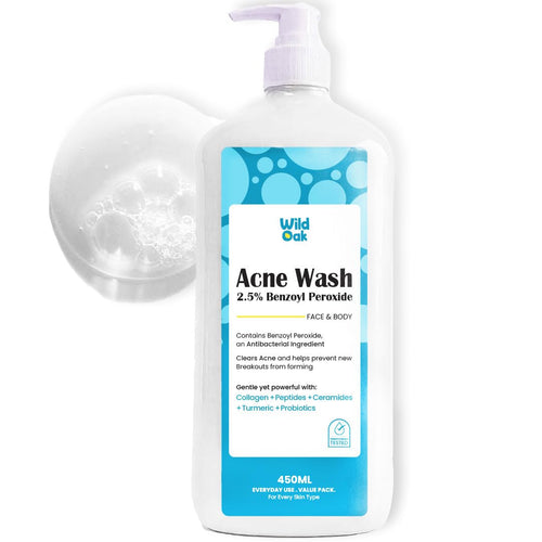 WildOak 2.5% Benzoyl Peroxide Acne Body Wash | 450ml Value Pack